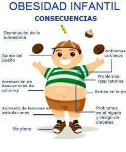 obesidad_infantil